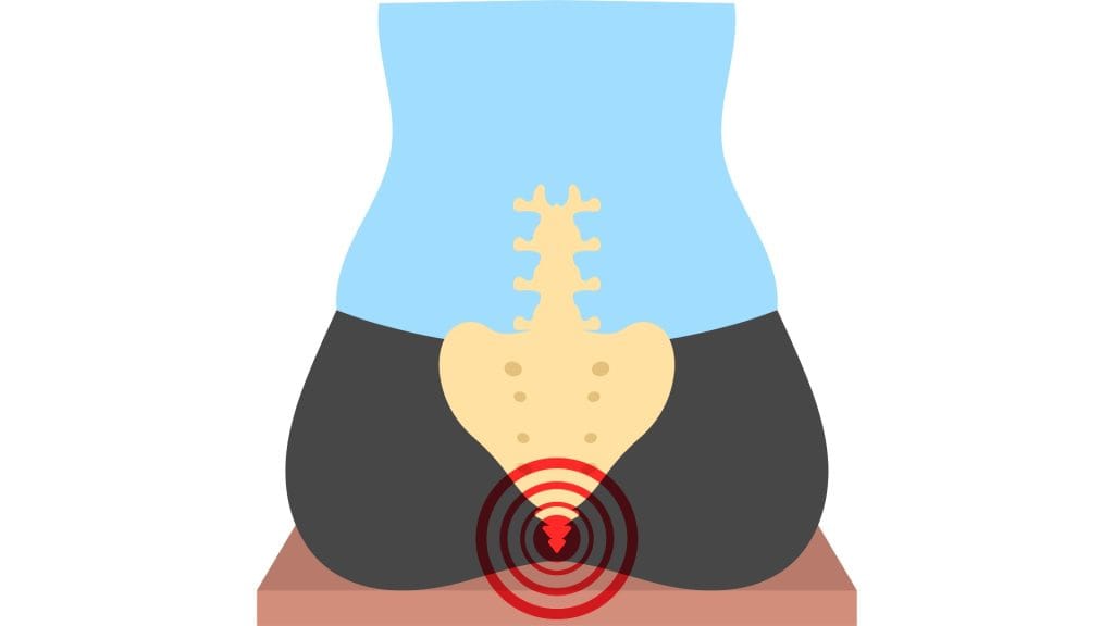 pilonidal sinus