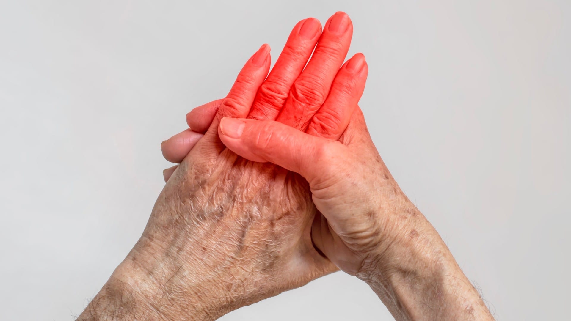 managing arthritis to flare-up